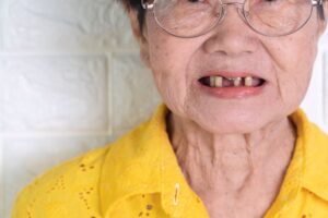 elderly woman with missing teeth